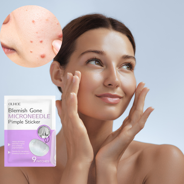 Microneedle Pimple Sticker  Kill Deep Cystic Pimples Overnight — Before They Explode